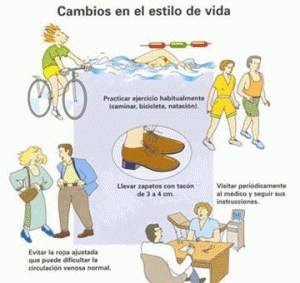 prevenir varices